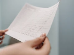 Papier termiczny do elektrokardiografów – na co zwrócić uwagę przy zakupie