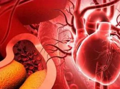 Statyny, cholesterol i prawdziwa przyczyna chorób serca