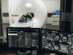 Nowa metoda analizy obrazu rezonansu opracowana. Pomoże to diagnostykę uszkodzeń nerwy wzrokowego