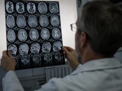 Pierwsza taka immunoterapia u ludzi wydłużyła przeżycie bez progresji glejaka ponad dwukrotnie