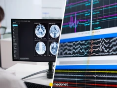 Co się dzieje tuż przed śmiercią? Naukowcy przekonują, że nie jest tak źle, jak się sądzi