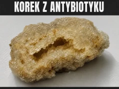 Organizm pomylił antybiotyk z cementem