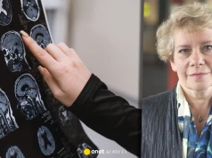 Neurolog z Harvardu chce zatrzymać alzheimera. Ostrzega, że sama zmiana stylu życia nie wystarczy