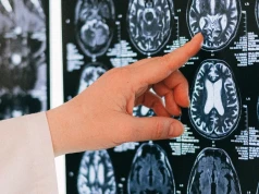 Światowy Dzień Mózgu. „Choroby neurologiczne dotyczą nawet 1 na 3 osoby”. Badanie u ponad 1000 seniorów daje nadzieję