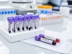 Pojedyncza próbka krwi może przewidzieć nawrót raka jelita grubego. Szansa na dokładniejsze rokowanie