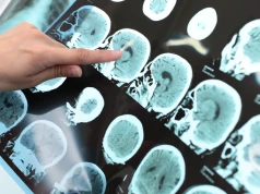 Eksperymentalna immunoterapia daje nadzieję dzieciom z agresywnymi guzami mózgu