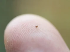 Masz to na ciele? Nie ignoruj. Łatwo pomylić ją z pieprzykiem