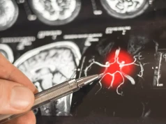 Odkryto, dlaczego niektóre mózgi opierają się Alzheimerowi. To może pomóc w leczeniu