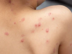 To wina Brytyjczyków. Poznaliśmy przyczynę niszczycielskiej epidemii z 1789