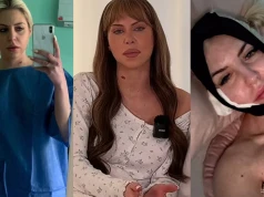 Julia von Stein wyznała, że żałuje nieudanego liftingu twarzy. "Dobrze, że opowiedziała o konsekwencjach"