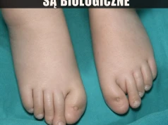 Siniak? Nie, fundament pod nowy szkielet