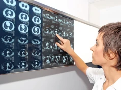 Rak płuca: darmowa tomografia od 1 października. Zobacz zasady programu
