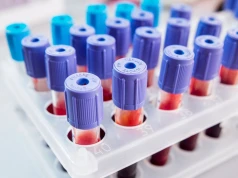 Konflikt serologiczny w ciąży - objawy, przyczyny, badania i profilaktyka