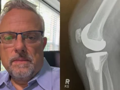 Wrona przez lata zwlekał z operacją. Wyjawił, co po zabiegu usłyszał od lekarza