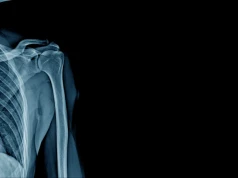 Czy inhibitory pompy protonowej zwiększają ryzyko osteoporozy?