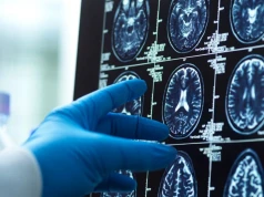 Co powoduje rozwój choroby Alzheimera? "Kolejny ważny element układanki"