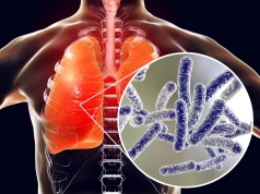 Legionella może namnażać się w instalacji wodnej. Tych objawów nie lekceważ