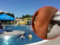 7-latek „zassany” przez atrakcję na pływalni w Częstochowie. Policja wyjaśnia okoliczności zdarzenia