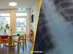 Gruźlica pojawiła się w warszawskim przedszkolu. Lekarze badają kolejne dzieci