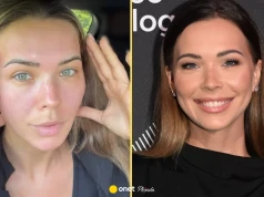 Sandra Kubicka czeka na operację plastyczną. "Już tak nie będę wyglądać"