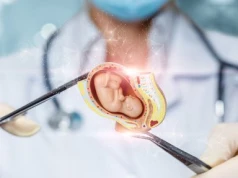 Chicago kolebką aborcyjną dla Amerykanek
