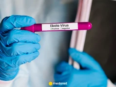 Rekordowa epidemia eboli w Kongu. Ponad 2 tys. ofiar i 4 tys. zakażonych