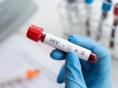 Drugie podejście. Jest nowy projekt w sprawie finansowania diagnostyki HCV i leczenia HIV