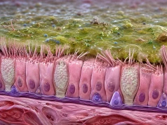 Genotyp i ultrastruktura rzęsek u dzieci z pierwotną dyskinezą rzęsek – dane z serii przypadków