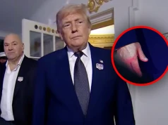 Lekarz byłego prezydenta zobaczył siniaki Trumpa. Jaśniej się nie da! „Zbyt długo trzymano nas w niewiedzy”