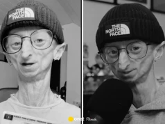 Nie żyje 28-letni influencer. Zmagał się z niezwykle rzadką chorobą