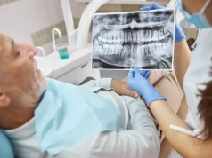 All-on-6 - odbudowa całego łuku zębowego na sześciu implantach