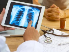 Rak płuca zabija najczęściej. Oto nietypowe objawy, które mogą opóźnić diagnozę i leczenie