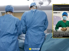 Lekarze usunęli mężczyźnie gigantyczny kamień moczowy. "Ważył tyle, co donoszony płód"