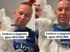 Gratka dla fanów Skolima. Ogłoszono konkurs w którym do wygrania jest jego gips