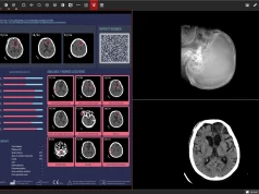 Polska jako pierwsza w Europie wdroży AI w diagnostyce na skalę ogólnokrajową