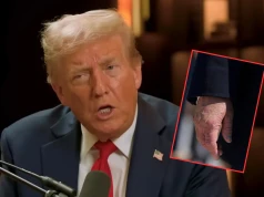 Co się dzieje Trumpem? Makijaż nie pomógł, TO zdjęcie wszystko zdradziło. „Zdeformowana dłoń”
