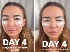 Sandra Kubicka pokazała, jak wygląda po operacji powiek. "Zaczynam ruszać oczami"