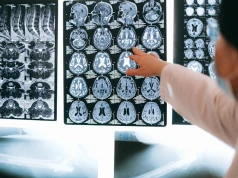 AI wspierała neurochirurga podczas operacji mózgu. Pierwszy taki zabieg na świecie