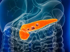 FDA zatwierdza daraxonrasib. Nowa terapia dla pacjentów z rakiem trzustki