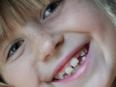 Białe plamy na zębach dziecka. Skąd się biorą i kiedy warto zgłosić się do dentysty