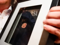 Ma 170 lat i jest wart miliony. Ten niezwykły znaczek można zobaczyć w Pradze