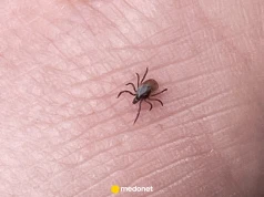 Czym możemy zarazić się od kleszcza? Borelioza to nie wszystko