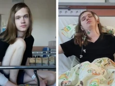 Lubelski student biomedycyny walczy z agresywnym guzem mózgu. Rodzina prosi o pomoc