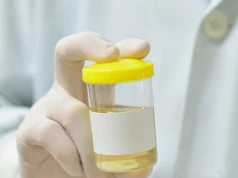 Test GALEAS Bladder wykrywa raka pęcherza z 92-procentową skutecznością