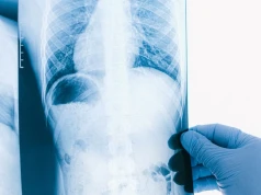 Wziewny lek zmniejszył opór w naczyniach płucnych i poprawił wydolność pacjentów. Nowa terapia pozytywnymi wynikami badania II fazy
