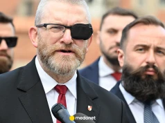 Dlaczego Braun ma czarną opaskę na oku? Ujawnił powód. "Trzeba się oswoić"