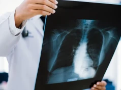 „Ludzie nie myślą kategoriami chorób. Zauważają objawy”. Włóknienie płuc: tu liczy się czas