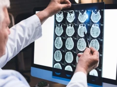Neurolog: napędza rozwój alzheimera. Robimy to sobie przez lata