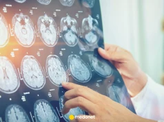 Badacze znaleźli w mózgu dwa odrębne systemy. To może zmienić leczenie chorób neurologicznych