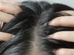 Wyrok na tłuste włosy. Ten szampon działa jak pochłaniacz sebum